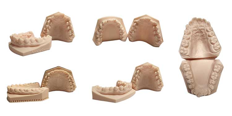 Orthodontic 3D Printing
